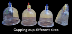 Loose Plastic Cups And Cupping Guns